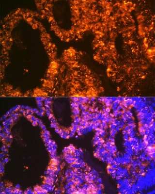 Immunohistochemistry: LIN-28A Antibody (2S1I10) [NBP3-16843] - Immunofluorescence analysis of human ovary using LIN-28A Rabbit mAb (NBP3-16843) at dilution of 1:100 (40x lens). Blue: DAPI for nuclear staining.