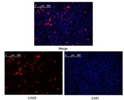 Immunocytochemistry/Immunofluorescence: LIN-28A Antibody (6D1F9) [NBP1-28865] - Analysis of methanol fixed Hela cells were transfected with pMX construct of human LIN28, cells were analyzed ~62 hours after transfection.
