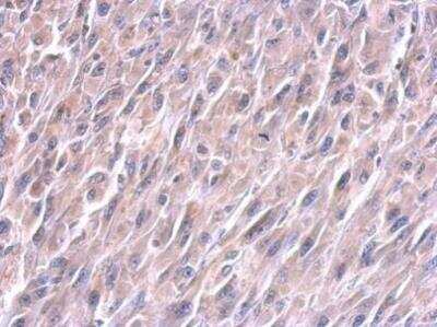 Immunohistochemistry: LIN-28A Antibody (717) [NBP2-43672] - Analysis of U87 xenograft. Lin28A antibody dilution: 1:100.