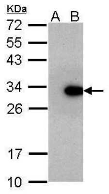 Western Blot: LIN-28A Antibody (717) [NBP2-43672] - Analysis of 30 ug whole cell lysate. A: Non-transfected HeLa lysates B: LIN28 transfected HeLa lysates 12% SDS PAGE diluted at 1:1000.