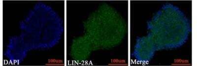 Immunocytochemistry/Immunofluorescence: LIN-28A Antibody [NBP1-49537] - Immunofluorescence staining showed that the newly formed GL261 spheres highly expressed Lin-28A. Image collected and cropped by CiteAb from the following publication (//www.nature.com/articles/cddiscovery2016105) licensed under a CC-BY license.