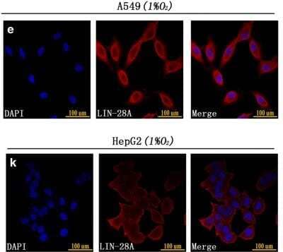 <b>Biological Strategies Validation. </b>Immunocytochemistry/Immunofluorescence: LIN-28A Antibody [NBP1-49537] - (e) Immunofluorescence staining showed that A549 CD133-negative cells highly expressed Lin-28A after 48 h of 1% O2 exposure. (k) Immunofluorescence staining showed that HepG2 CD133-negative cells highly expressed Lin-28A after 48 h of 1% O2 exposure.Image collected and cropped by CiteAb from the following publication (//www.nature.com/articles/cddiscovery2016105) licensed under a CC-BY license.