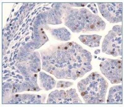 Immunohistochemistry: LIN-28A Antibody [NBP1-49537] - Analysis of LIN28 in E17.5 mouse embryo.