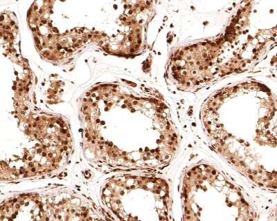 Immunohistochemistry-Paraffin: LIN-28A Antibody (JA10-63) [NBP2-66932] - Analysis of paraffin-embedded human testis tissue with Rabbit anti-LIN-28A antibody washed with ddH2O and PBS, and then probed with the primary antibody  at 1/400 dilution for 1 hour at room temperature. The detection was performed using an HRP conjugated compact polymer system. DAB was used as the chromogen. Tissues were counterstained with hematoxylin and mounted with DPX.