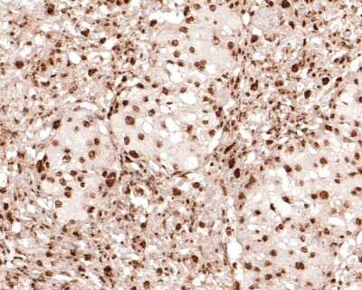 Immunohistochemistry-Paraffin: LIN-28A Antibody (JA10-63) [NBP2-66932] - Analysis of paraffin-embedded mouse placenta tissue with Rabbit anti-LIN-28A antibody washed with ddH2O and PBS, and then probed with the primary antibody  at 1/400 dilution for 1 hour at room temperature. The detection was performed using an HRP conjugated compact polymer system. DAB was used as the chromogen. Tissues were counterstained with hematoxylin and mounted with DPX.