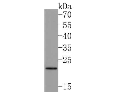 Western Blot: LIN-28A Antibody (JA10-63) [NBP2-66932] - Analysis of LIN-28A on K562 cell lysates. Proteins were transferred to a PVDF membrane and blocked with 5% BSA in PBS for 1 hour at room temperature. The primary antibody (1/500) was used in 5% BSA at room temperature for 2 hours. Goat Anti-Rabbit IgG - HRP Secondary Antibody at 1:200,000 dilution was used for 1 hour at room temperature. Predicted band size: 23 kDa Observed band size: 25 kDa