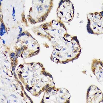 Immunohistochemistry-Paraffin: LIN-28B Antibody (7D7F7) [NBP3-16815] - Immunohistochemistry of paraffin-embedded human placenta using LIN-28B Rabbit mAb (NBP3-16815) at dilution of 1:100 (40x lens).Perform microwave antigen retrieval with 10 mM Tris/EDTA buffer pH 9.0 before commencing with IHC staining protocol.