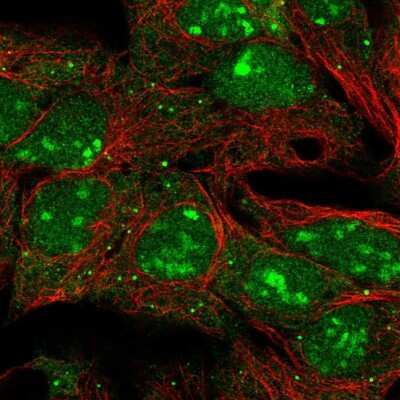 Immunocytochemistry/Immunofluorescence: LIN-28B Antibody [NBP2-32352] - Immunofluorescent staining of human cell line HEK 293 shows localization to nucleus, nucleoli & cytosol.