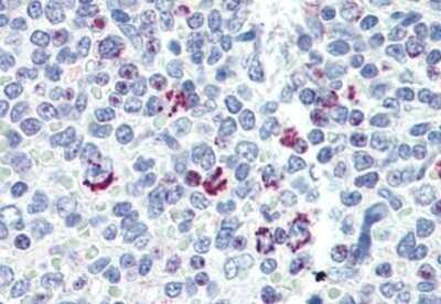 Immunohistochemistry-Paraffin: LIN-28B Antibody [NBP1-50529] - Analysis of anti-LIN28B antibody with human spleen at concentration 10 ug/ml.