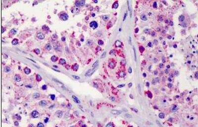 Immunohistochemistry-Paraffin: LIN-28B Antibody [NBP1-50529] - Human testis. Immunohistochemistry of formalin-fixed, paraffin-embedded tissue after heat-induced antigen retrieval. Antibody concentration 10 ug/ml.