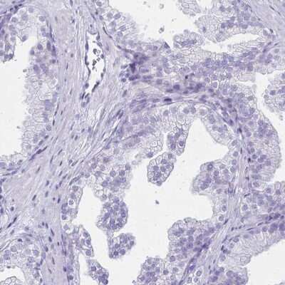 Immunohistochemistry-Paraffin: LIN-28B Antibody [NBP1-85438] - Staining of human prostate shows low expression as expected.