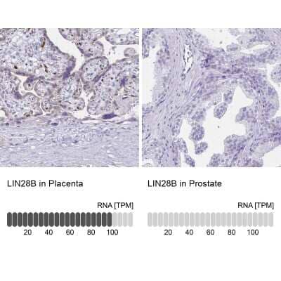 <b>Orthogonal Strategies Validation. </b>Immunohistochemistry-Paraffin: LIN-28B Antibody [NBP1-85438] - Staining in human placenta and prostate tissues using anti-LIN28B antibody. Corresponding LIN28B RNA-seq data are presented for the same tissues.