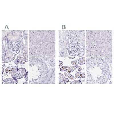 <b>Independent Antibodies Validation. </b>Immunohistochemistry-Paraffin: LIN-28B Antibody [NBP1-85438] - Staining of human kidney, liver, placenta and testis using Anti-LIN28B antibody NBP1-85438 (A) shows similar protein distribution across tissues to independent antibody NBP2-32352 (B).