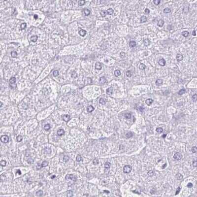 Immunohistochemistry-Paraffin: LIN-28B Antibody [NBP1-85438] - Staining of human liver.