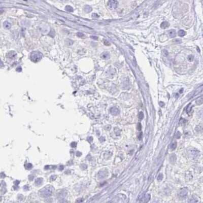 Immunohistochemistry-Paraffin: LIN-28B Antibody [NBP1-85438] - Staining of human testis.