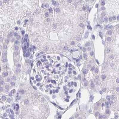 Immunohistochemistry-Paraffin: LIN-28B Antibody [NBP1-85438] - Staining of human kidney.