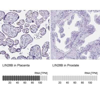 <b>Orthogonal Strategies Validation. </b>Immunohistochemistry-Paraffin: LIN-28B Antibody [NBP1-85438] - Analysis in human placenta and prostate tissues. Corresponding LIN-28B RNA-seq data are presented for the same tissues.