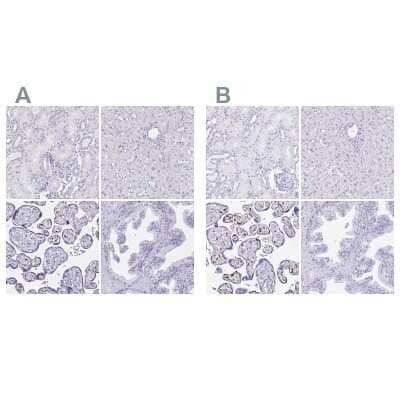 <b>Independent Antibodies Validation. </b>Immunohistochemistry-Paraffin: LIN-28B Antibody [NBP1-85438] - Staining of human kidney, liver, placenta and prostate using Anti-LIN-28B antibody NBP1-85438 (A) shows similar protein distribution across tissues to independent antibody NBP2-32352 (B).