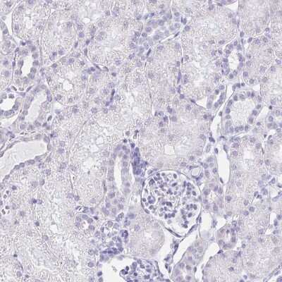 Immunohistochemistry-Paraffin: LIN-28B Antibody [NBP1-85438] - Staining of human kidney shows no positivity in cells in tubules as expected.