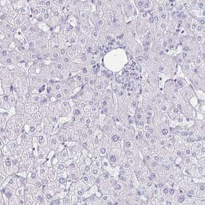 Immunohistochemistry-Paraffin: LIN-28B Antibody [NBP1-85438] - Staining of human liver shows no positivity in hepatocytes as expected.