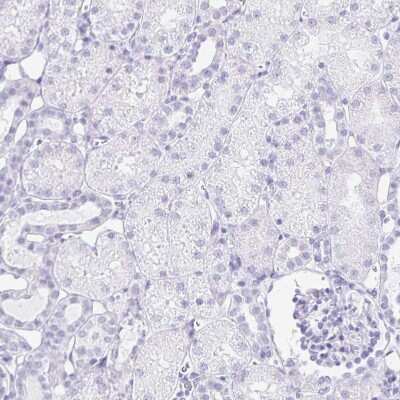 Immunohistochemistry-Paraffin: LIN-28B Antibody [NBP2-32352] - Staining of human kidney shows no positivity in cells in tubules as expected.