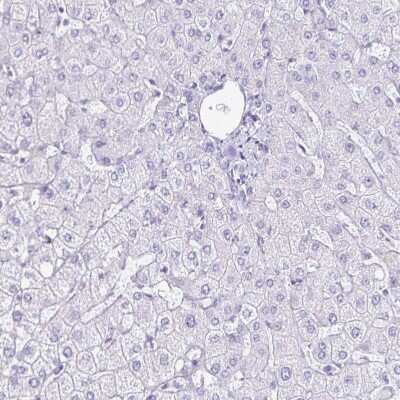 Immunohistochemistry-Paraffin: LIN-28B Antibody [NBP2-32352] - Staining of human liver shows no positivity in hepatocytes as expected.