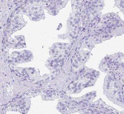 Immunohistochemistry-Paraffin: LIN-28B Antibody [NBP2-32352] - Staining of human prostate shows no positivity in glandular cells as expected.