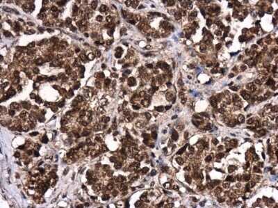 Immunohistochemistry-Paraffin: LIN-28B Antibody [NBP3-13029] - LIN-28B antibody detects LIN-28B protein at cytoplasm and nucleus in human colon by immunohistochemical analysis. Sample: Paraffin-embedded human colon. LIN-28B antibody (NBP3-13029) diluted at 1:500. Antigen Retrieval: Citrate buffer, pH 6.0, 15 min