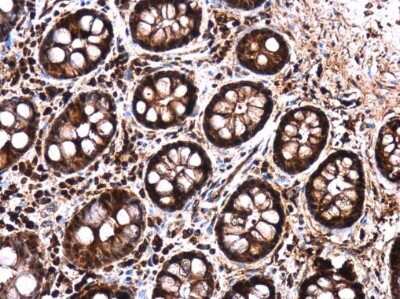 Immunohistochemistry-Paraffin: LIN-28B Antibody [NBP3-13029] - LIN-28B antibody detects LIN-28B protein at cytoplasm and nucleus in human ovary by immunohistochemical analysis. Sample: Paraffin-embedded human ovary. LIN-28B antibody (NBP3-13029) diluted at 1:500. Antigen Retrieval: Citrate buffer, pH 6.0, 15 min