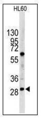 Western Blot: LIN-28B Antibody [NBP1-50529] - Analysis of anti-LIN28B antibody with HL60 cell line lysates (35ug/lane).