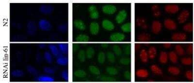 Immunocytochemistry/Immunofluorescence: LIN-61 Antibody [29590002] - This image is specific to animal number Q0824 Nuclear signal decreased after RNAi lin-61 but didn't go away completely.  Antibody dilution 1:1000