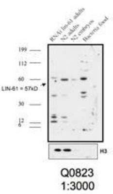 Western Blot: LIN-61 Antibody [29590002] - Detection of C. elegans LIN61 at a dilution of 1:3,000. LIN61 appeared at 57 kDa. Image courtesy of University of Cambridge, Ahringer Lab.
