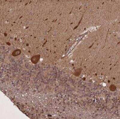 Immunohistochemistry-Paraffin: LIN37 Antibody [NBP2-30384] - Staining of human cerebellum shows strong cytoplasmic positivity in Purkinje cells.