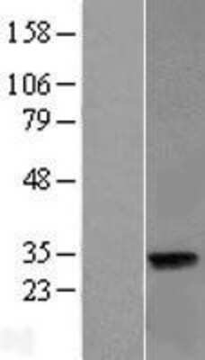 Western Blot LIN37 Overexpression Lysate