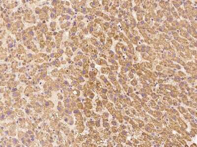 Immunohistochemistry-Paraffin: LIN52 Antibody [NBP2-99294] - Immunochemical staining LIN52 in human liver with rabbit polyclonal antibody at 1:200 dilution, formalin-fixed paraffin embedded sections.