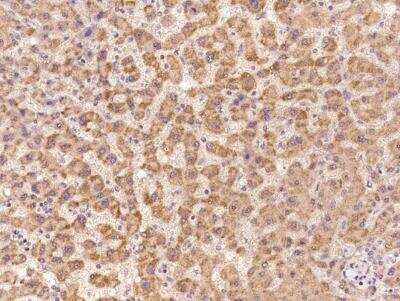 Immunohistochemistry-Paraffin: LIN52 Antibody [NBP3-06592] - Staining of human LIN52 in human liver with rabbit polyclonal antibody at 1:500 dilution.
