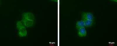 Immunocytochemistry/Immunofluorescence: LIN7 Antibody (377) [NBP2-43587] - Analaysis of Sample: MCF-7 cells were fixed in ice-cold MeOH for 5 min. Green: LIN7A protein stained by LIN7A antibody [377] diluted at 1:1000. Blue: Hoechst 33342 staining.