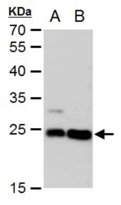 Western Blot: LIN7 Antibody (377) [NBP2-43587] - Analysis of A. 30 ug MCF-7 whole cell extract B. 30 ugMDA-MB-231 whole cell extract 12 % SDS-PAGE LIN7A antibody [377] dilution: 1:1000.