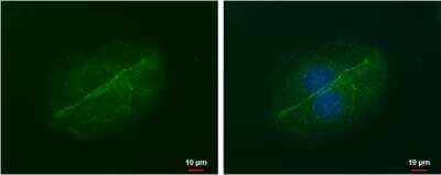 Immunocytochemistry/Immunofluorescence: LIN7 Antibody (879) [NBP2-43695] - Analysis of Sample: MCF-7 cells were fixed in ice-cold MeOH for 5 min. Green: LIN7A protein stained by LIN7A antibody [879] diluted at 1:500. Blue: Hoechst 33342 staining.