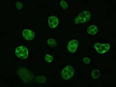 Immunocytochemistry/Immunofluorescence: LIN7 Antibody [NBP2-99481] - Immunofluorescence staining of LIN7 in MCF7 cells. Cells were fixed with 4% PFA, permeabilzed with 0.1% Triton X-100 in PBS, blocked with 10% serum, and incubated with rabbit anti-human LIN7 polyclonal antibody (dilution ratio 1:1000) at 4C overnight. Then cells were stained with the Alexa Fluor(R)488-conjugated Goat Anti-rabbit IgG secondary antibody (green). Positive staining was localized to cytoplasm and cell membrane.