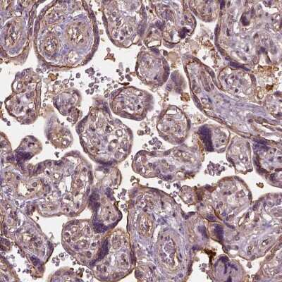 Immunohistochemistry: LIN7 Antibody [NBP2-68921] - Immunohistochemical staining of human placenta shows strong membranous positivity in trophoblastic cells.