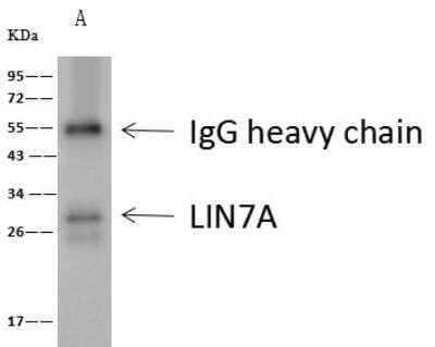 Immunoprecipitation: LIN7 Antibody [NBP2-99481] - Lane A:0.5 mg HepG2 Whole Cell Lysate4 uL anti-ATP6V1C1 rabbit polyclonal antibody and 60 ug of Immunomagnetic beads Protein A/G.Primary antibody:Anti-ATP6V1C1 rabbit polyclonal antibody,at 1:100 dilution Secondary antibody:Clean-Blot IP Detection Reagent (HRP) at 1:1000dilutionDeveloped using the ECL technique.Performed under reducing conditions.Predicted band size: 44 kDaObserved band size :45 kDa