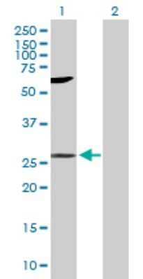 Western Blot: LIN7 Antibody [H00008825-B01P] - Analysis of LIN7A expression in transfected 293T cell line by LIN7A polyclonal antibody.  Lane 1: LIN7A transfected lysate(25.63 KDa). Lane 2: Non-transfected lysate.