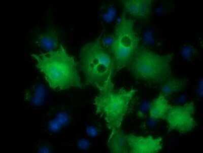 Immunocytochemistry/Immunofluorescence: LIN7B Antibody (OTI1C9) - Azide and BSA Free [NBP2-72131] - Staining of COS7 cells transiently transfected by pCMV6-ENTRY LIN7B.