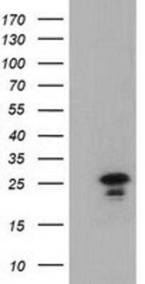 Western Blot: LIN7B Antibody (OTI1C9) - Azide and BSA Free [NBP2-72131] - HEK293T cells were transfected with the pCMV6-ENTRY control (Left lane) or pCMV6-ENTRY LIN7B (Right lane) cDNA for 48 hrs and lysed. Equivalent amounts of cell lysates (5 ug per lane) were separated by SDS-PAGE and immunoblotted with anti-LIN7B.