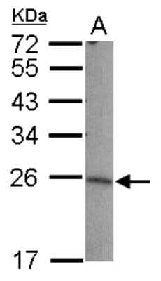 Western Blot: LIN7B Antibody [NBP2-19358] - Sample (30 ug of whole cell lysate) A: 293T 12% SDS PAGE gel, diluted at 1:1000.