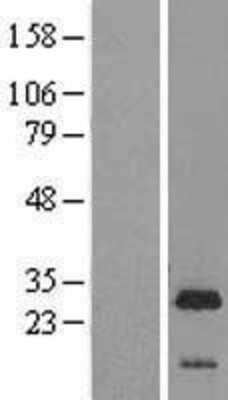 Western Blot: LIN7B Overexpression Lysate (Adult Normal) [NBL1-12544] Left-Empty vector transfected control cell lysate (HEK293 cell lysate); Right -Over-expression Lysate for LIN7B.