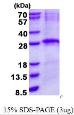 SDS-Page: LIN7B Protein [NBP2-23198]