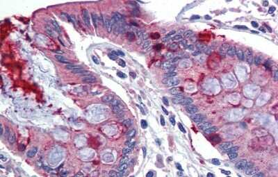 Immunohistochemistry-Paraffin: LIN7C Antibody [NBP1-53082] - Human Colon Tissue, antibody concentration 5 ug/ml.