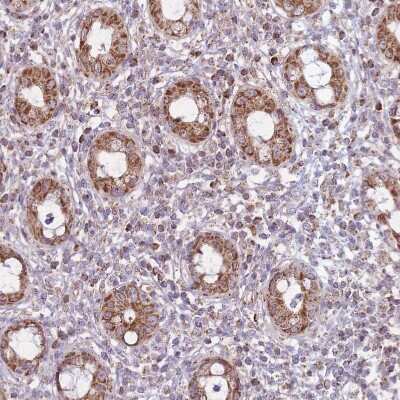 Immunohistochemistry-Paraffin: LIN7C Antibody [NBP2-14193] - Staining of human rectum shows moderate granular cytoplasmic positivity in glandular cells.